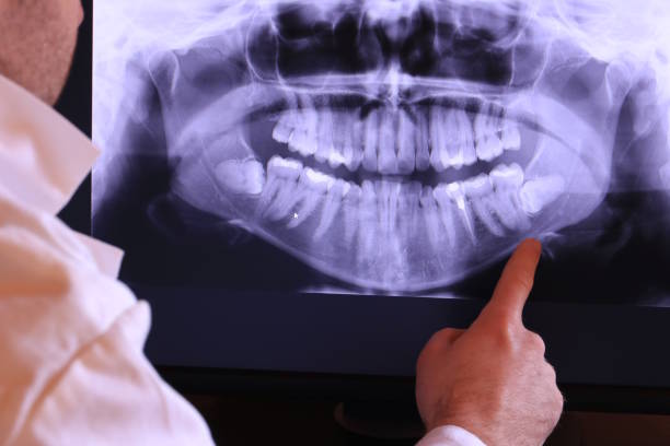 Best Emergency Root Canal Treatment in Millcreek, UT